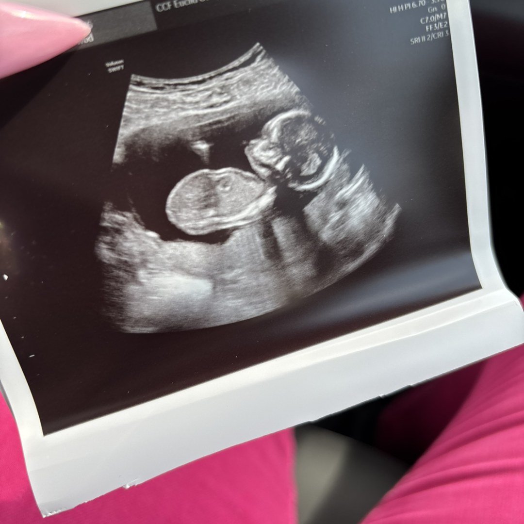 Photo shared by Nicole for their Babylist baby registry.