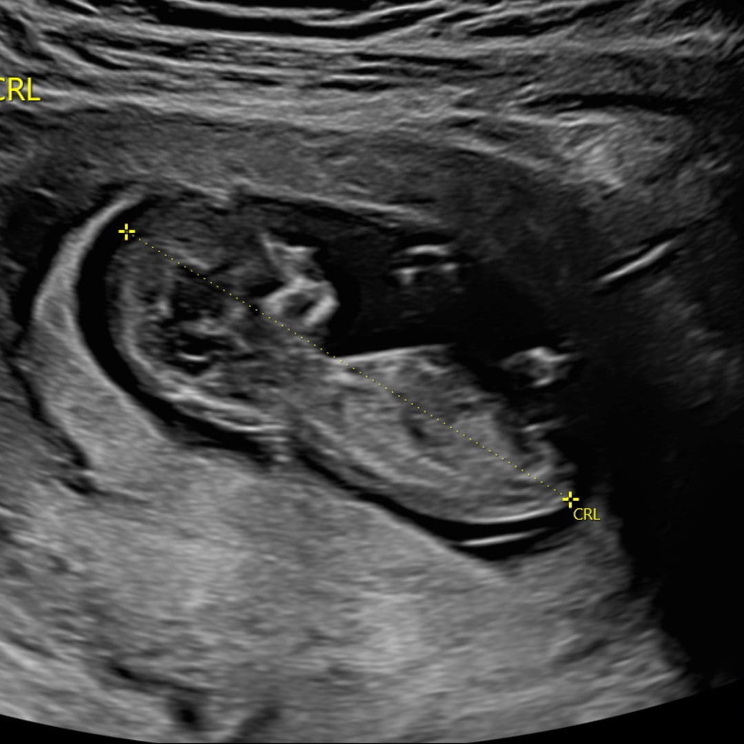 Photo shared by Faira for their Babylist baby registry.