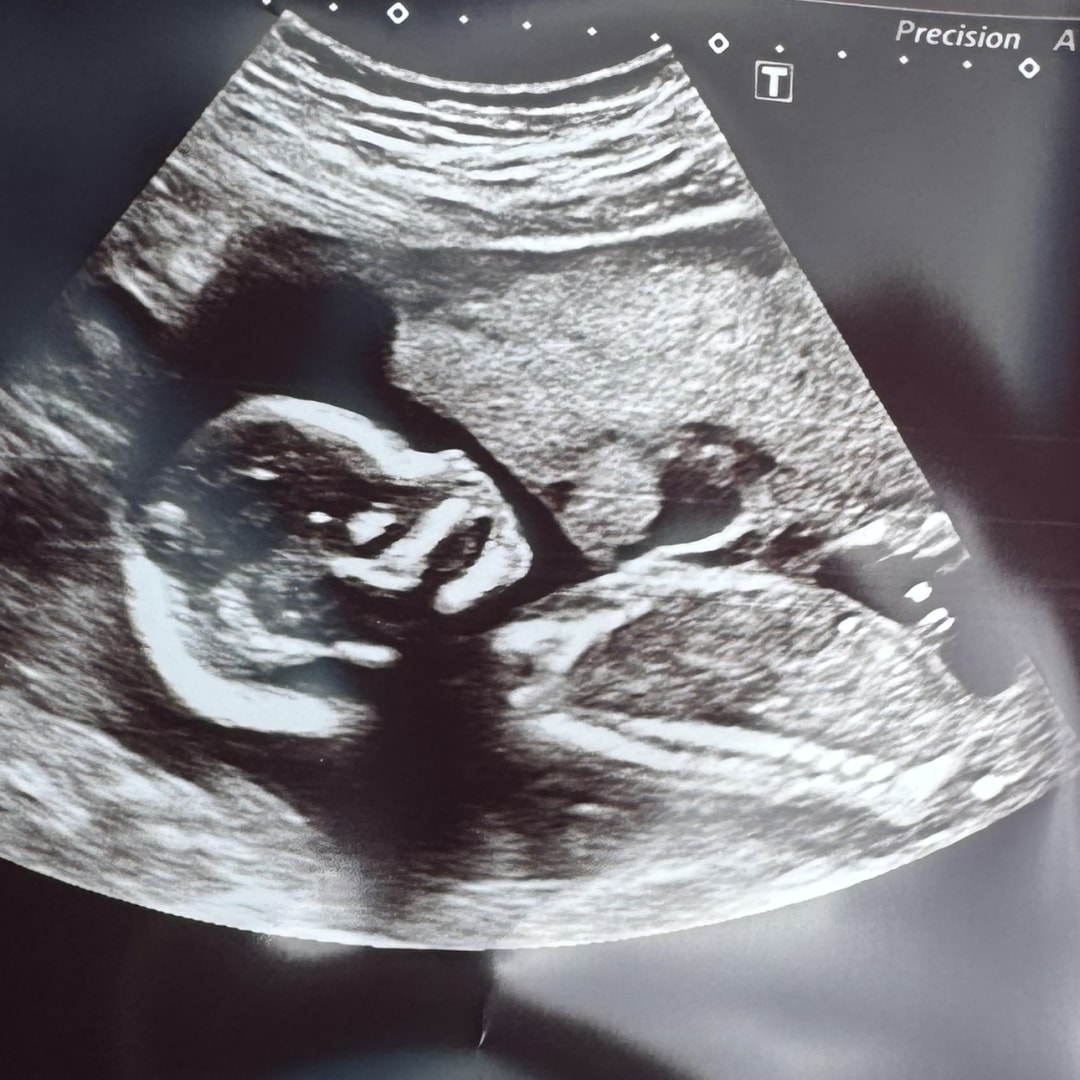 Photo shared by Hannah for their Babylist baby registry.