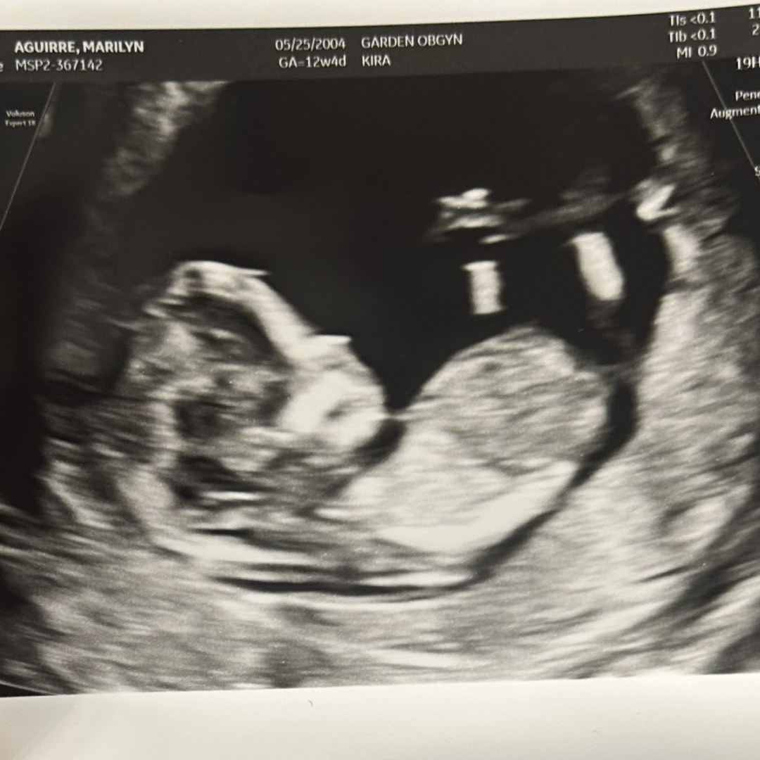 Photo shared by Marilyn for their Babylist baby registry.