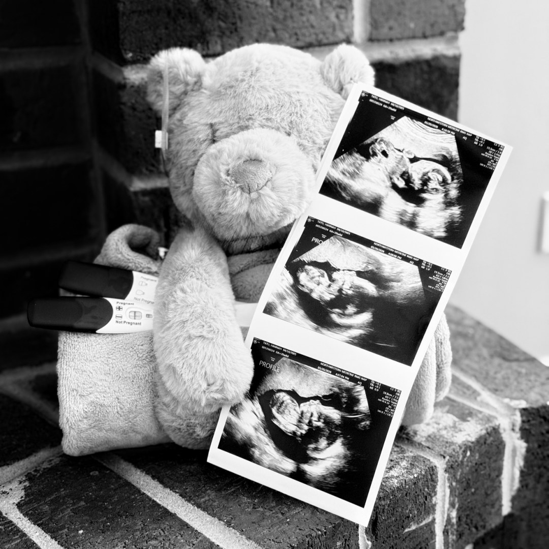 Photo shared by Hannah for their Babylist baby registry.