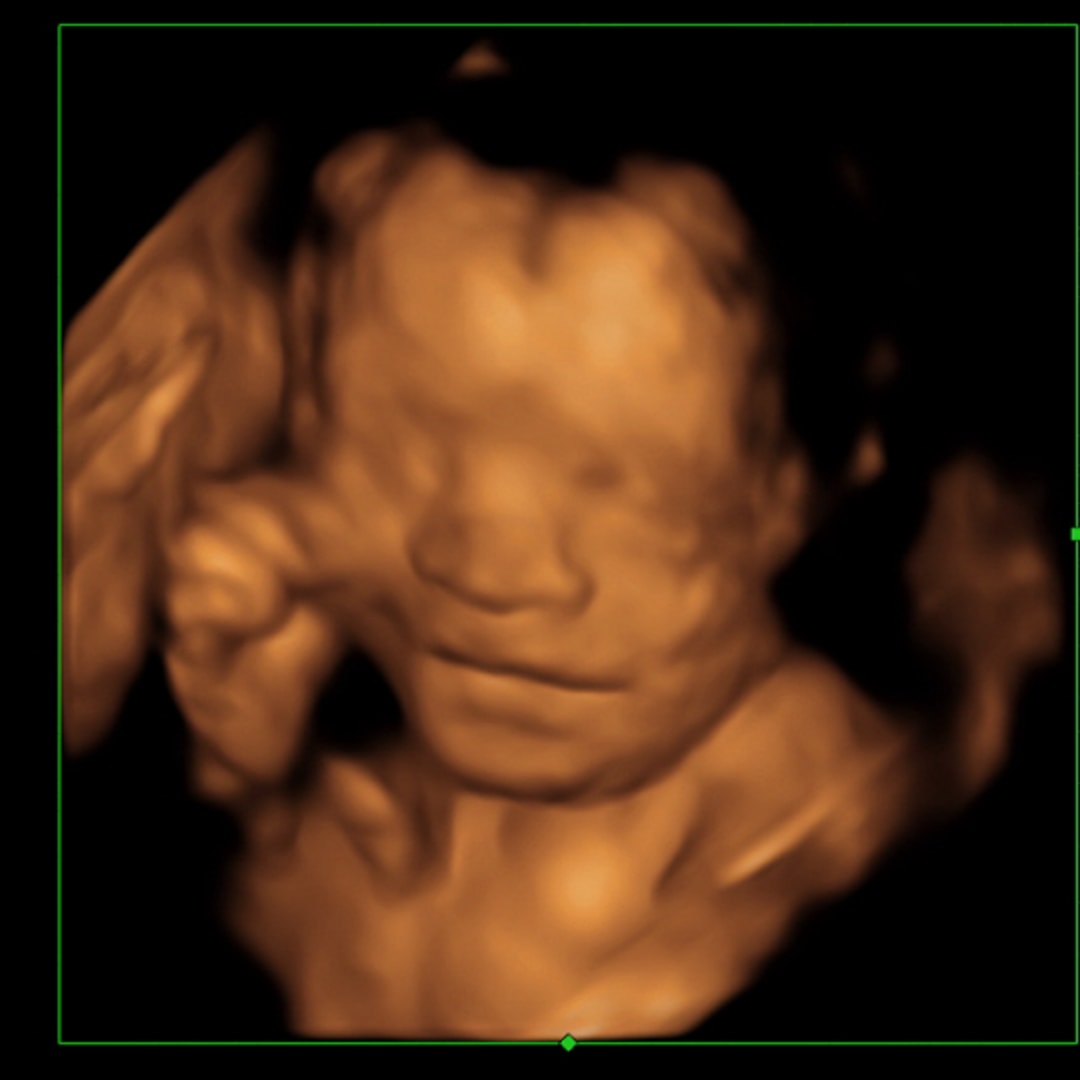 Photo shared by Jan for their Babylist baby registry.