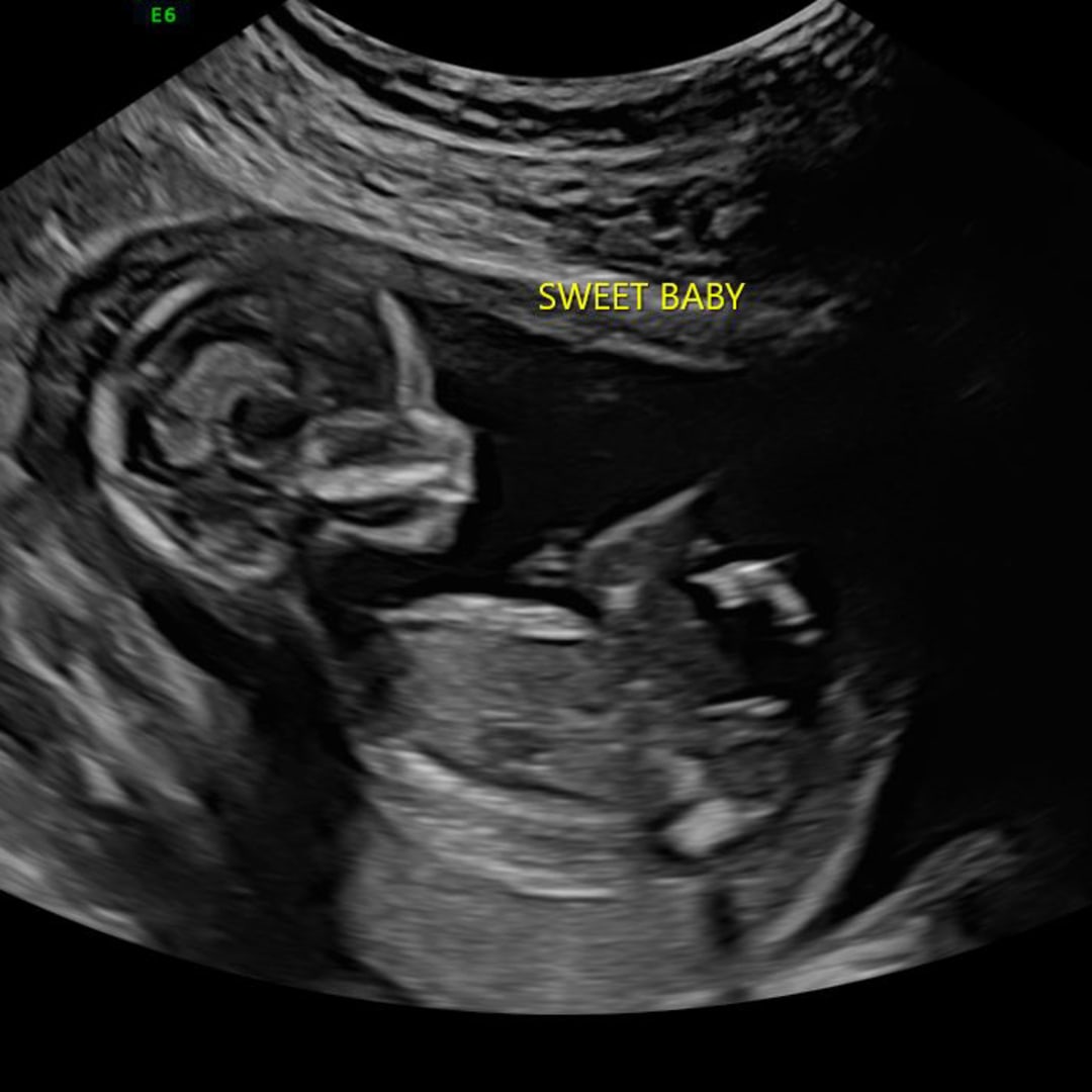 Photo shared by Rachel for their Babylist baby registry.