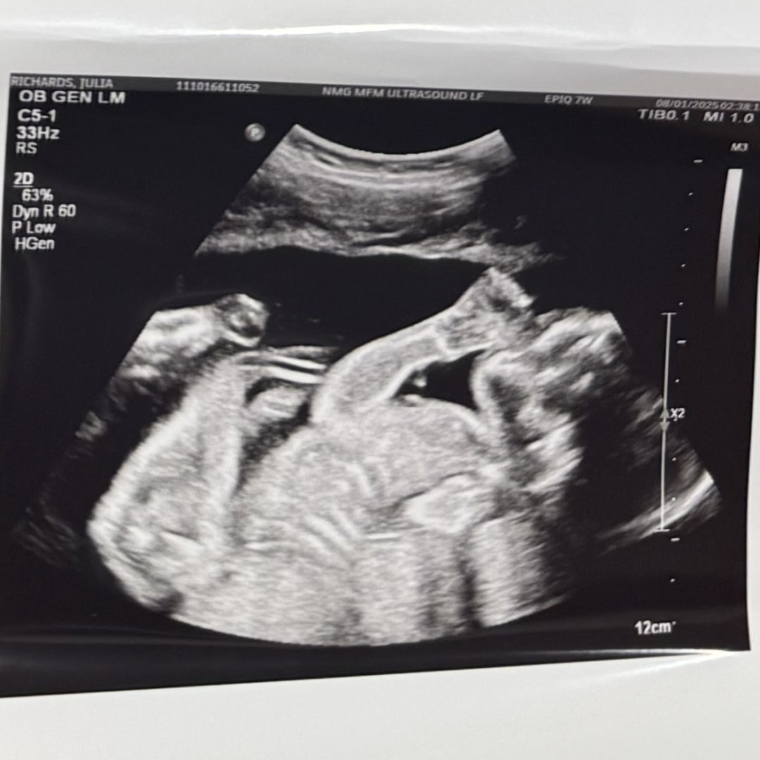 Photo shared by Julia for their Babylist baby registry.