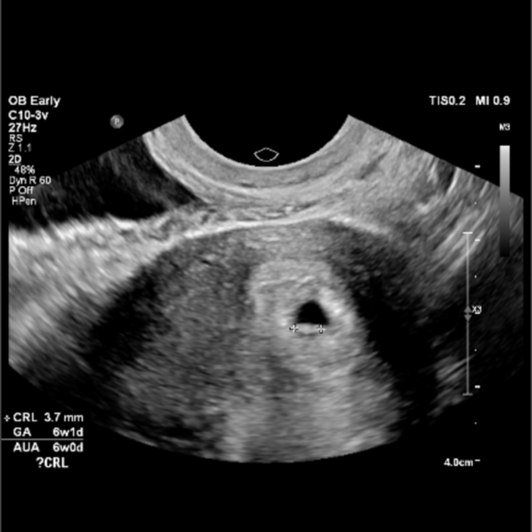 Photo shared by Katie for their Babylist baby registry.