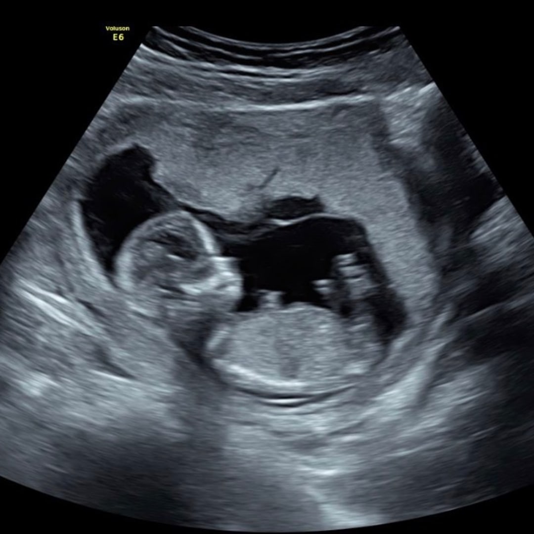 Photo shared by Savannah for their Babylist baby registry.