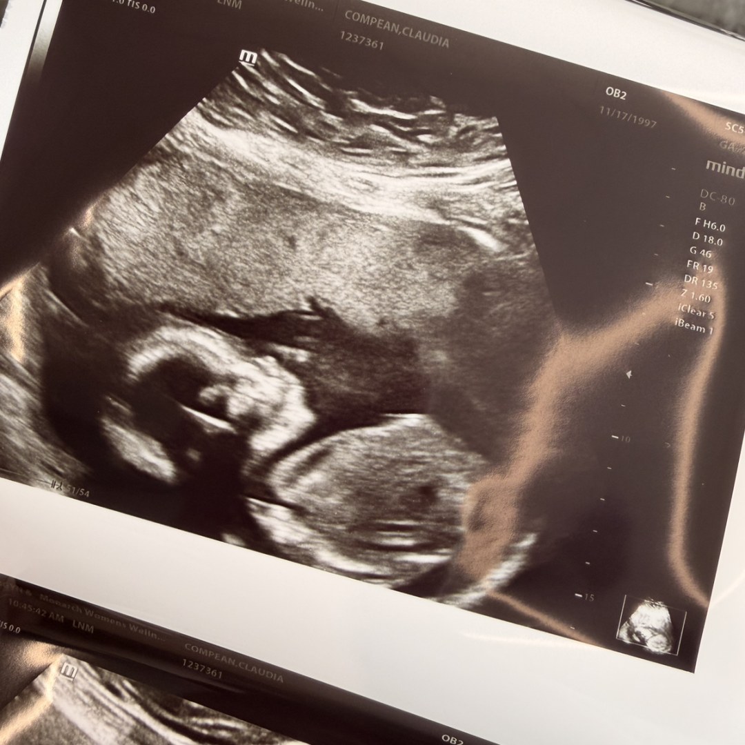 Photo shared by Claudia for their Babylist baby registry.