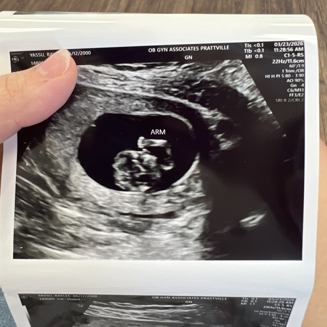 Photo shared by Baylee and Andrew for their Babylist baby registry.
