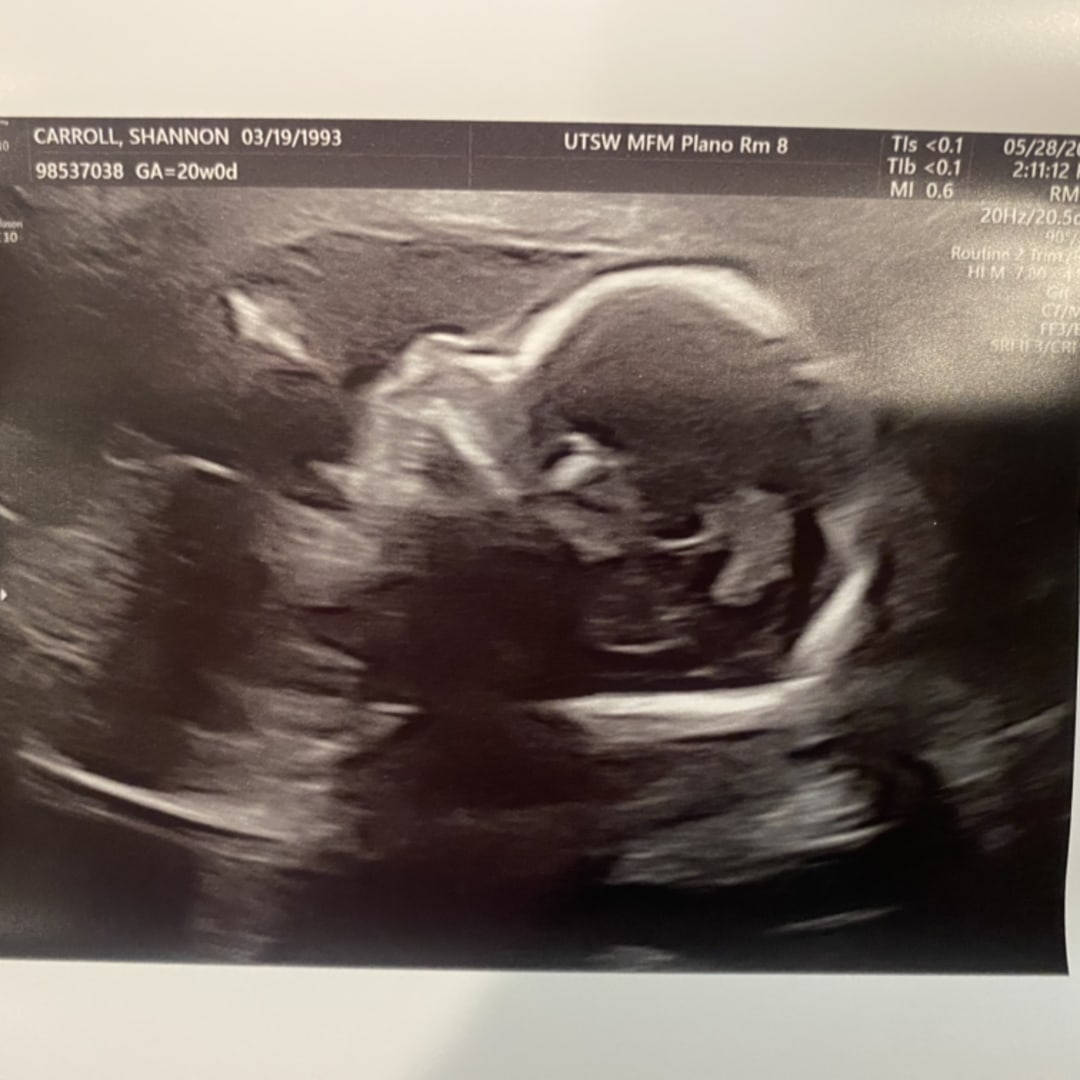 Photo shared by Amanda for their Babylist baby registry.