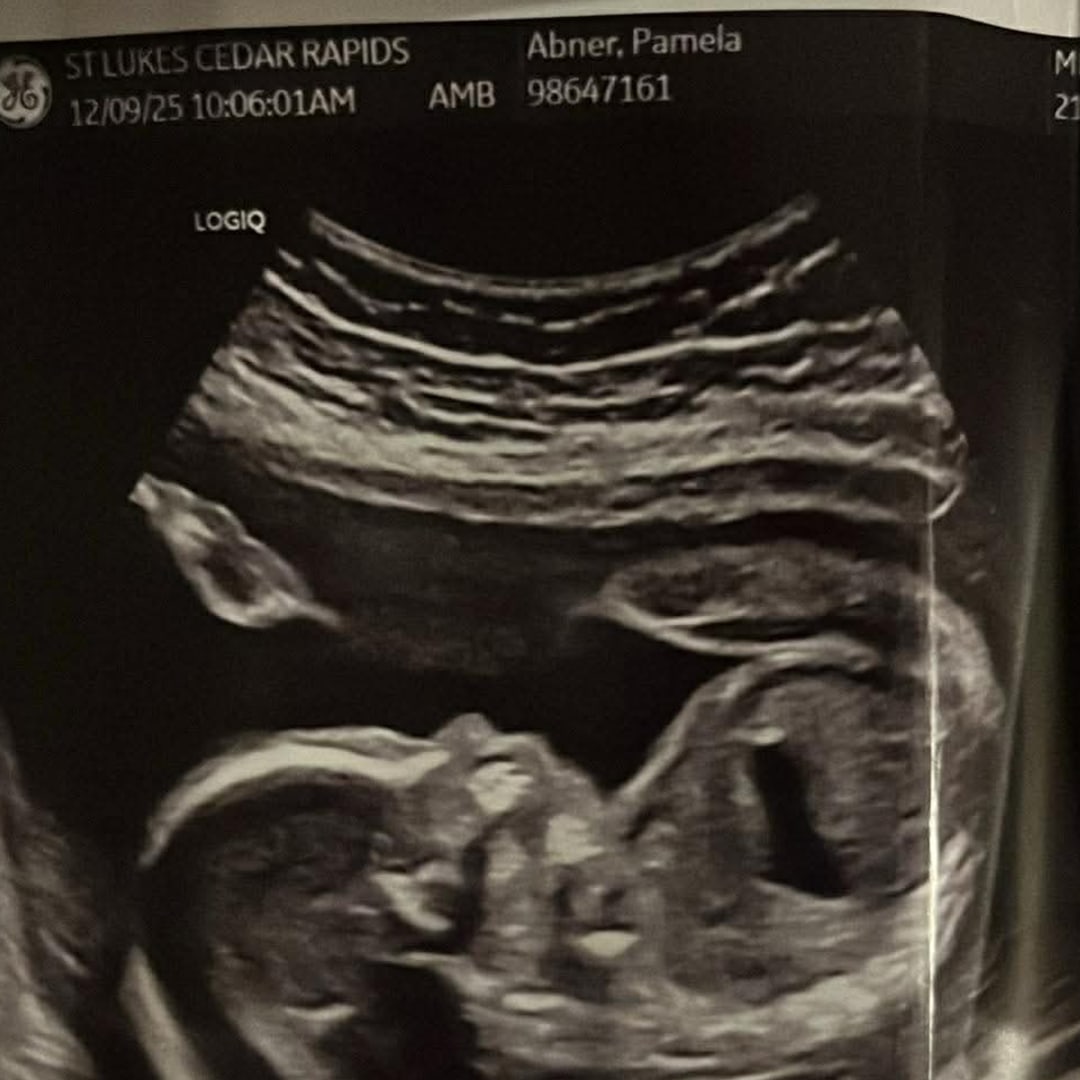 Photo shared by Pamela for their Babylist baby registry.