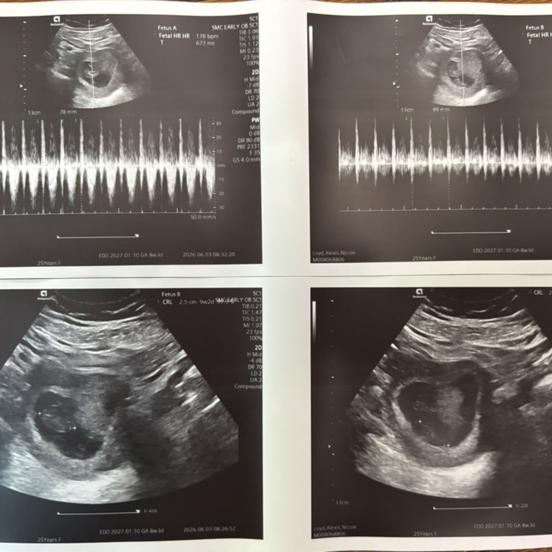 Photo shared by Alexis for their Babylist baby registry.
