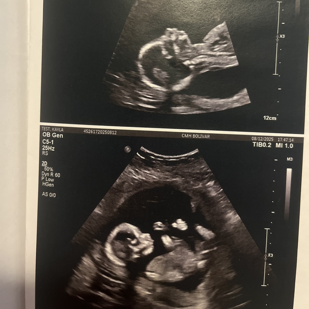Photo shared by Kayla for their Babylist baby registry.
