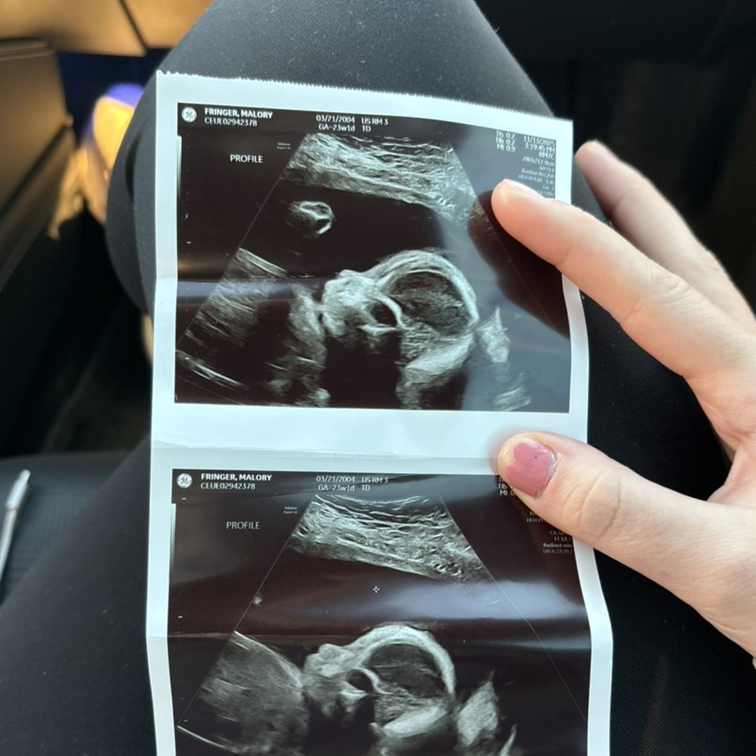 Photo shared by Malory for their Babylist baby registry.