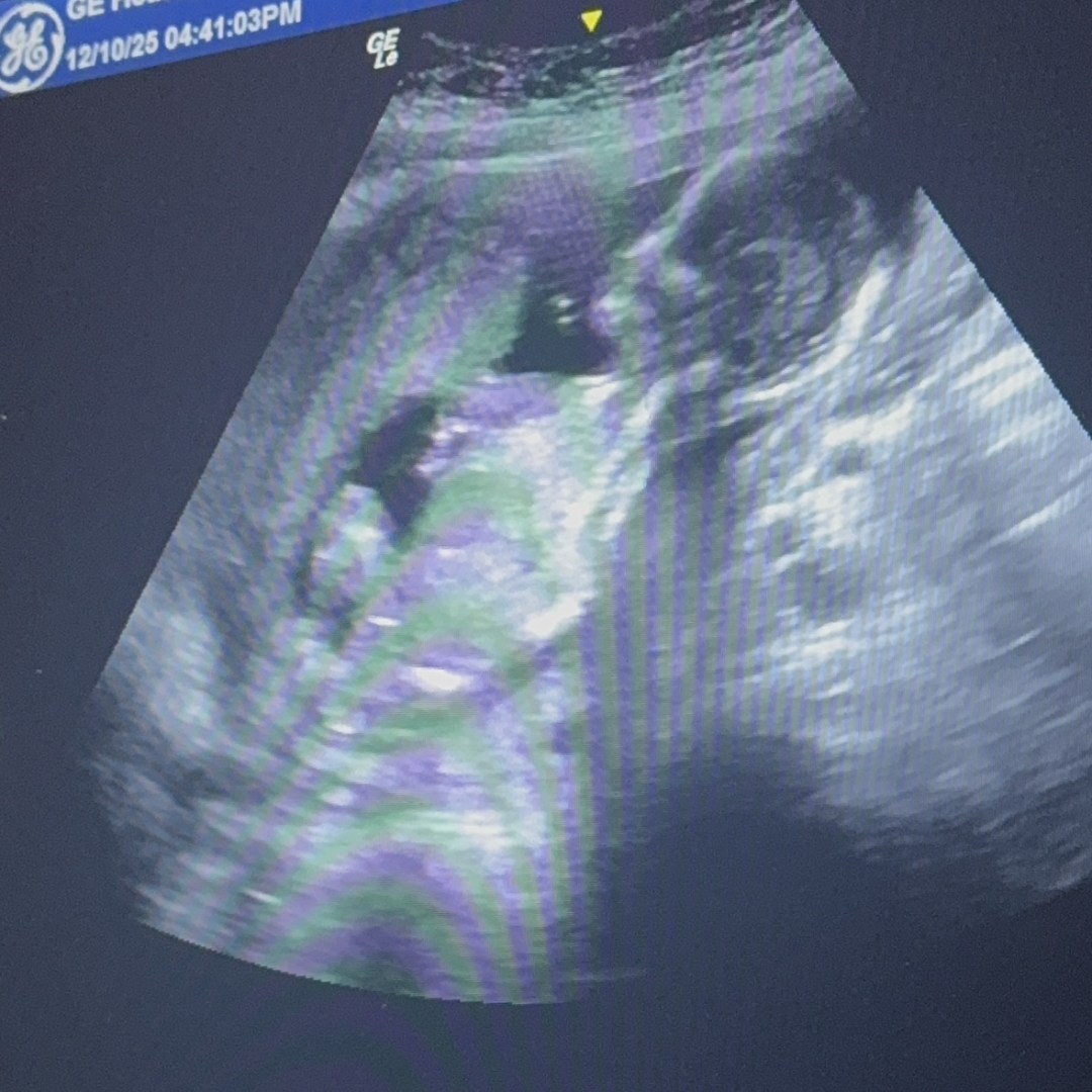 Photo shared by Kimber for their Babylist baby registry.