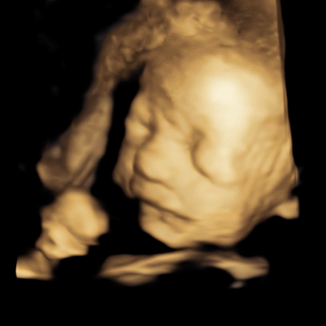 Photo shared by Jamie for their Babylist baby registry.