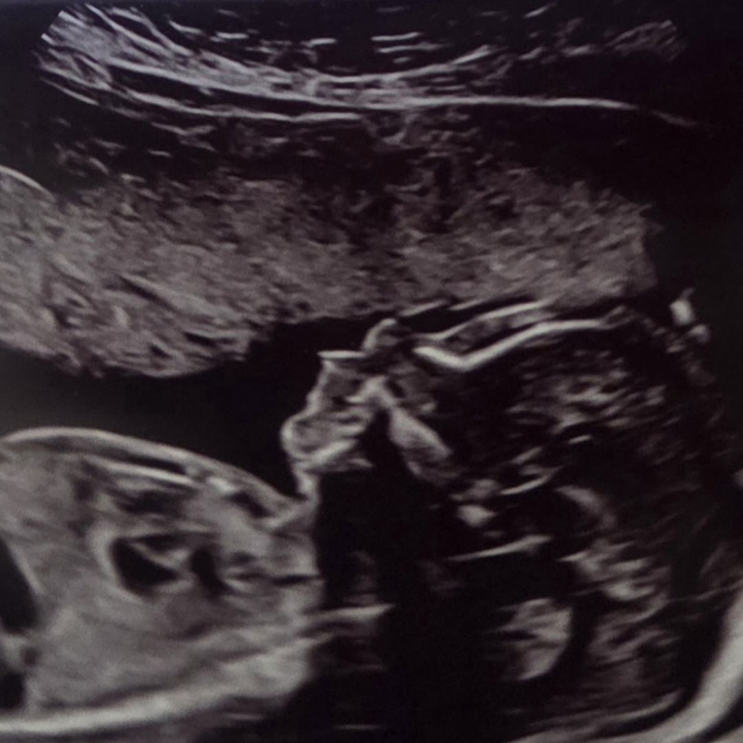 Photo shared by Diana for their Babylist baby registry.