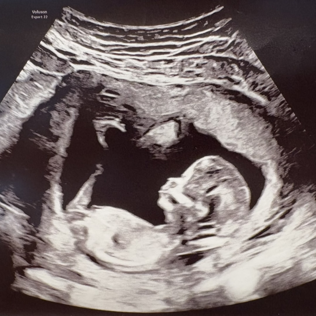 Photo shared by Rebecca for their Babylist baby registry.