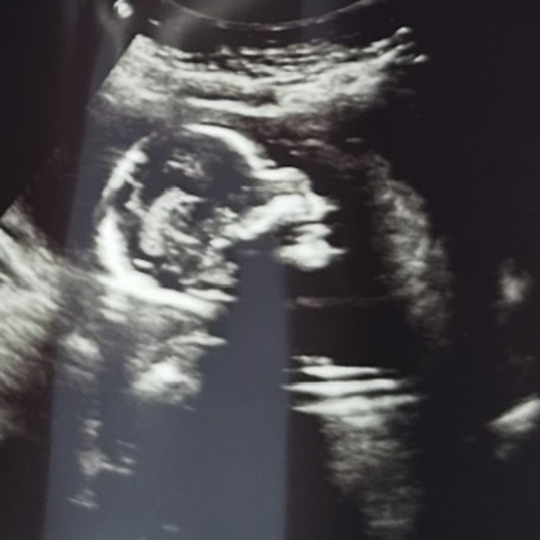 Photo shared by Stephanie for their Babylist baby registry.