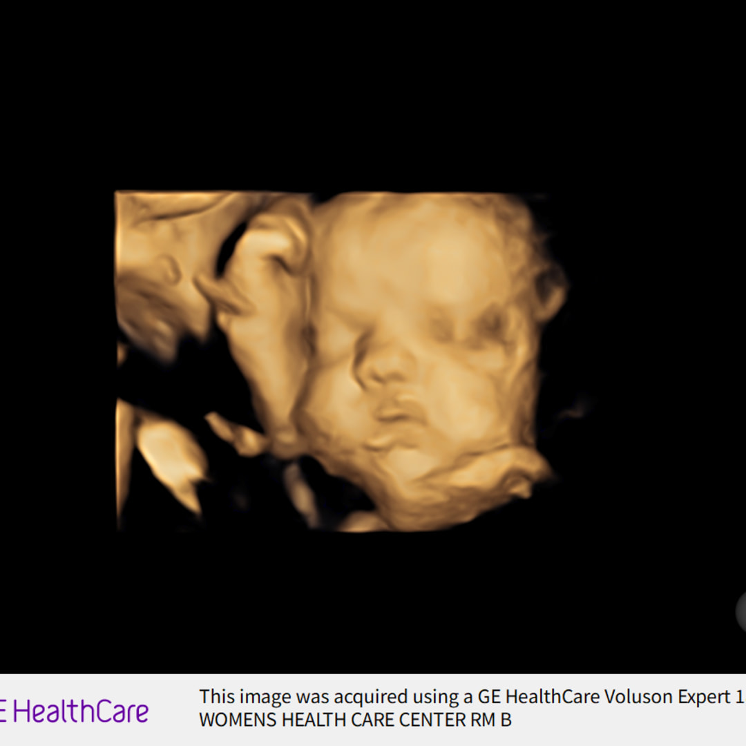 Photo shared by Amber for their Babylist baby registry.