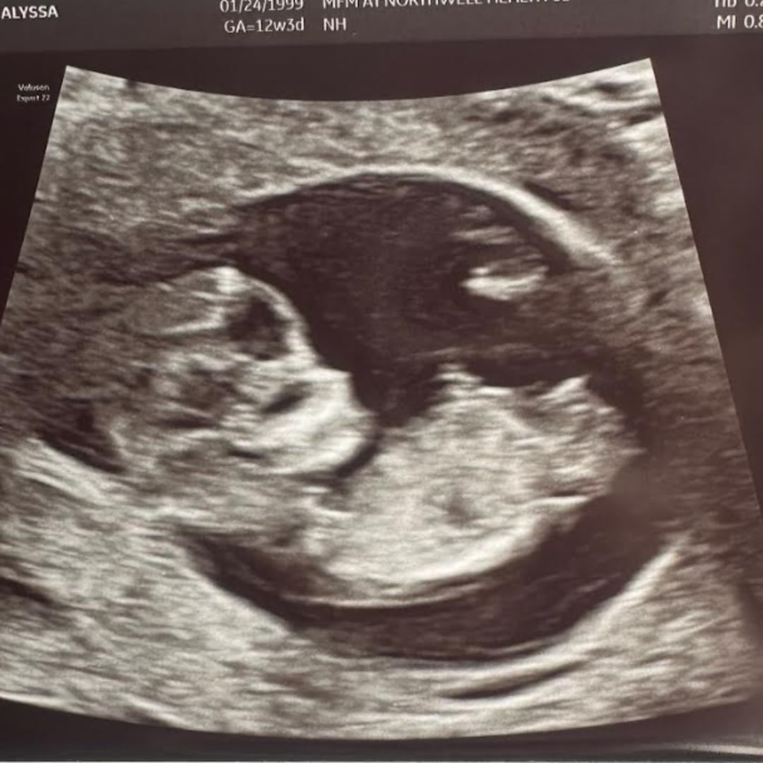 Photo shared by Alyssa for their Babylist baby registry.