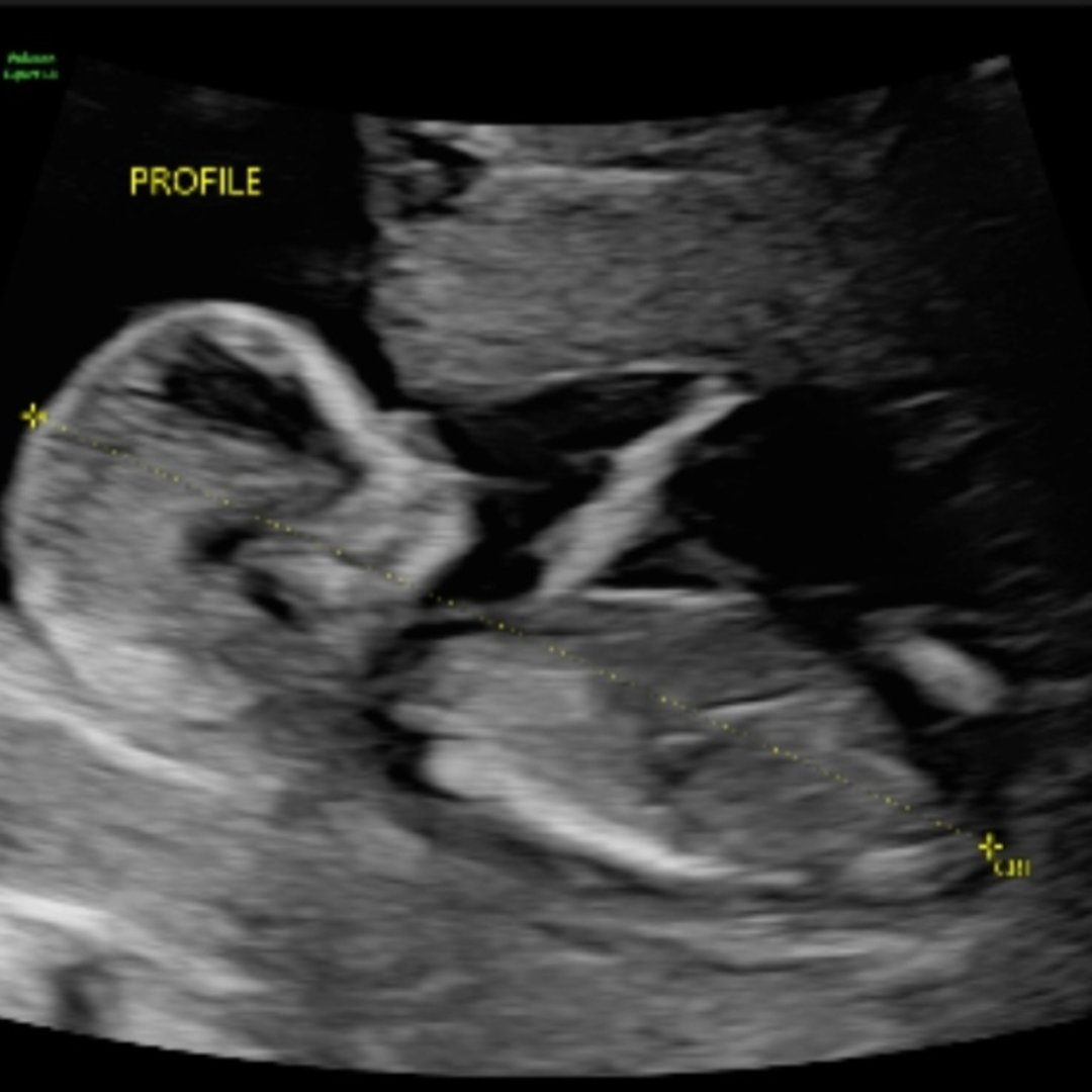 Photo shared by Dana for their Babylist baby registry.