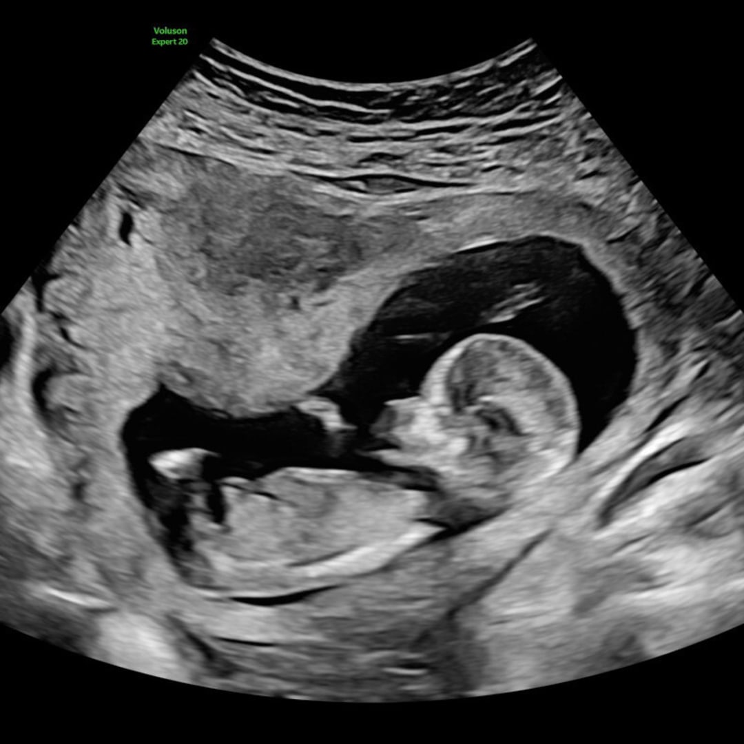 Photo shared by Brianna for their Babylist baby registry.