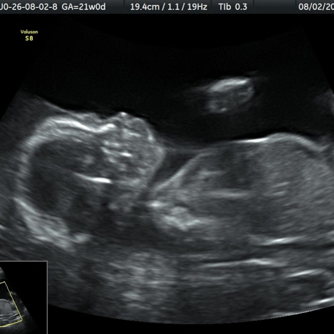Photo shared by Julia for their Babylist baby registry.