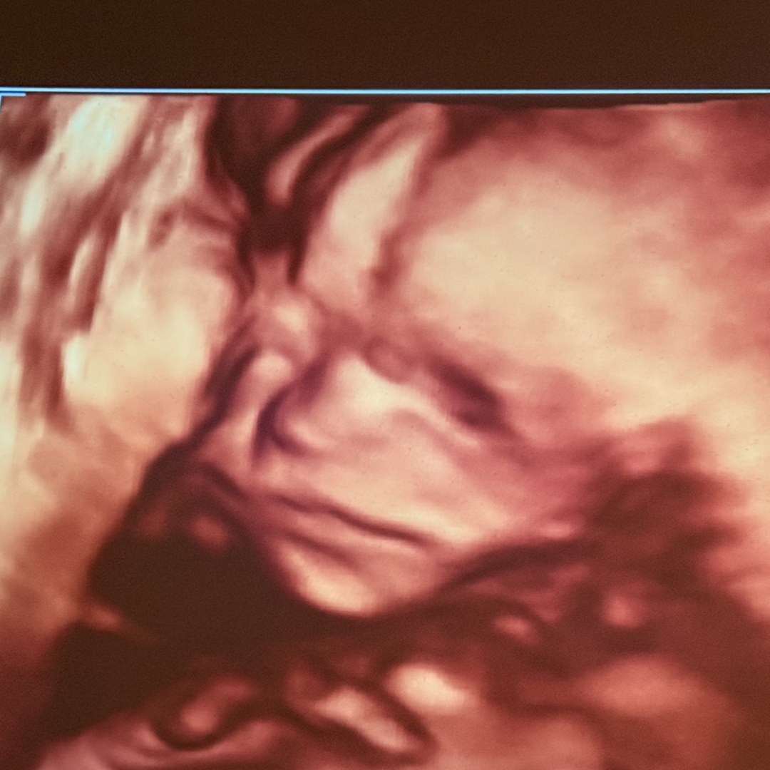 Photo shared by Hanna for their Babylist baby registry.