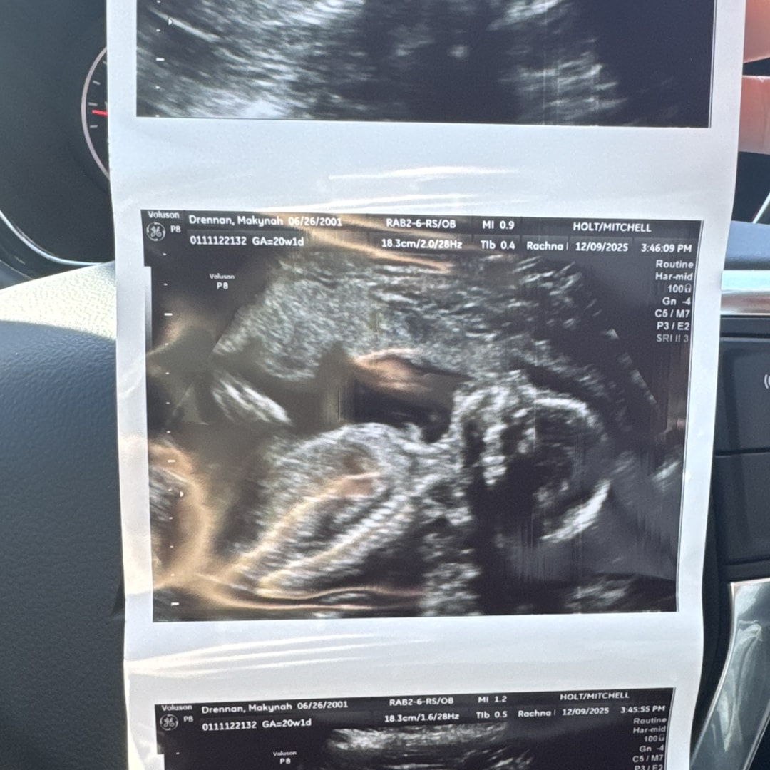 Photo shared by Makynah for their Babylist baby registry.