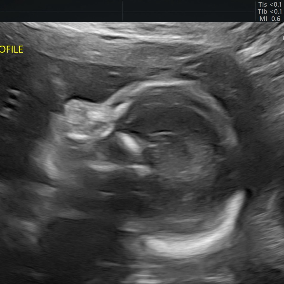 Photo shared by Gianna for their Babylist baby registry.