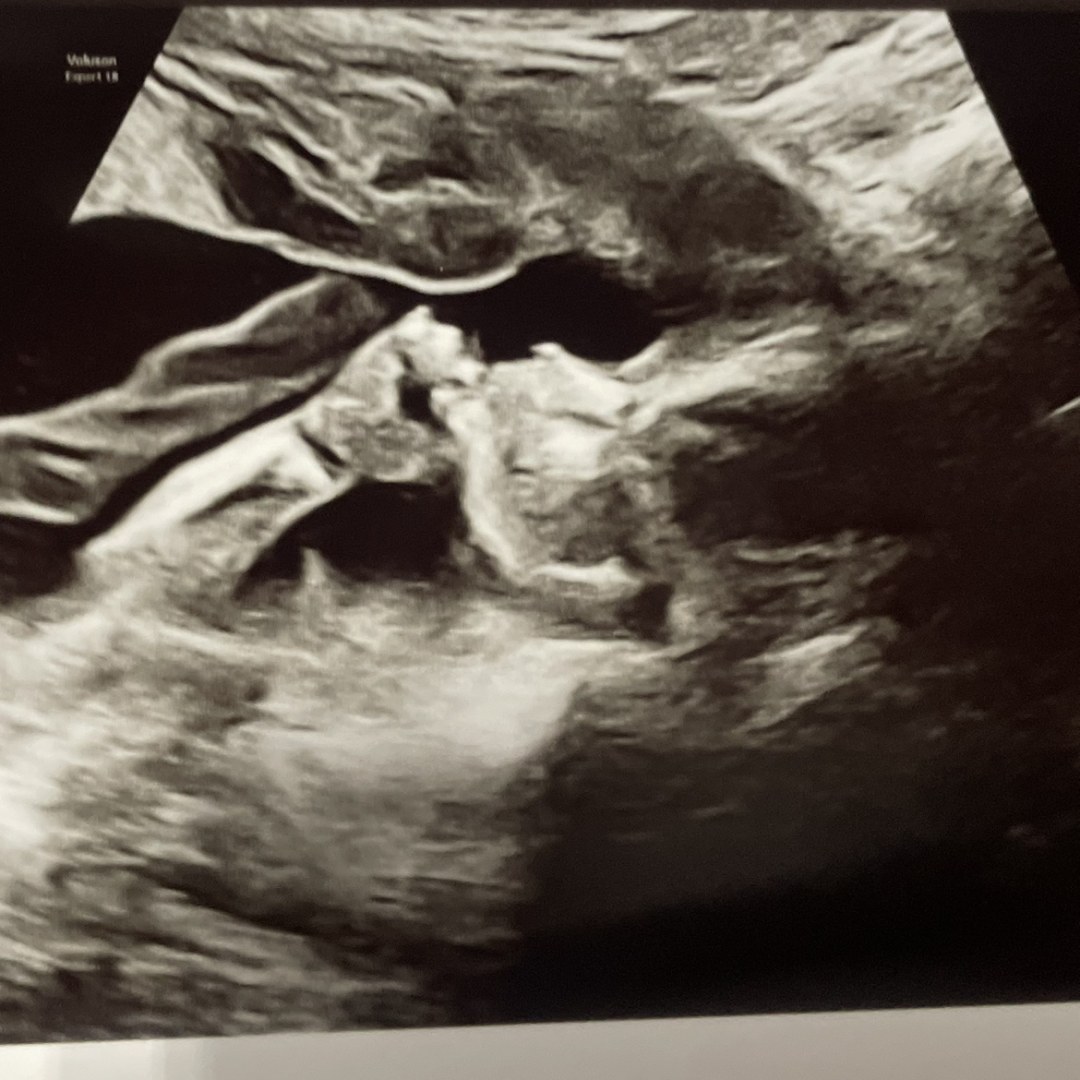 Photo shared by Emily for their Babylist baby registry.