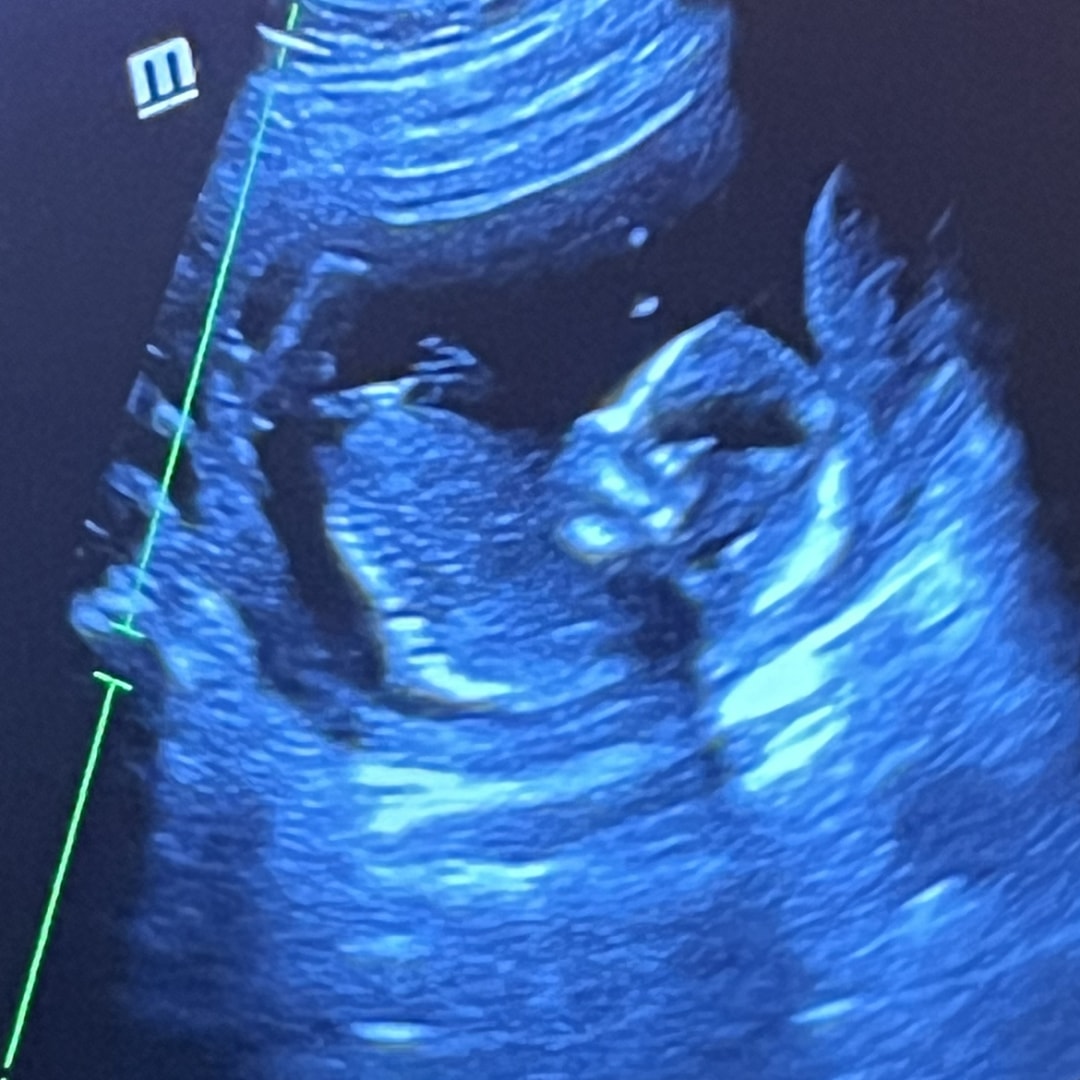 Photo shared by Haley for their Babylist baby registry.