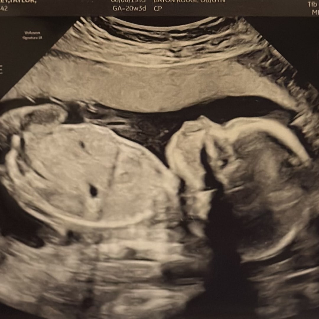 Photo shared by Taylor for their Babylist baby registry.