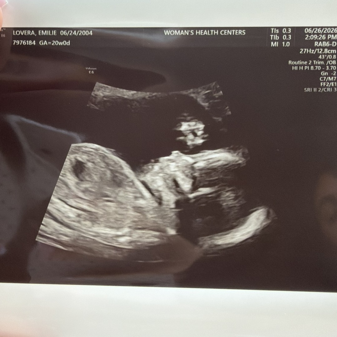Photo shared by Emilie for their Babylist baby registry.