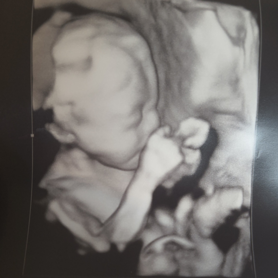 Photo shared by Josephine for their Babylist baby registry.