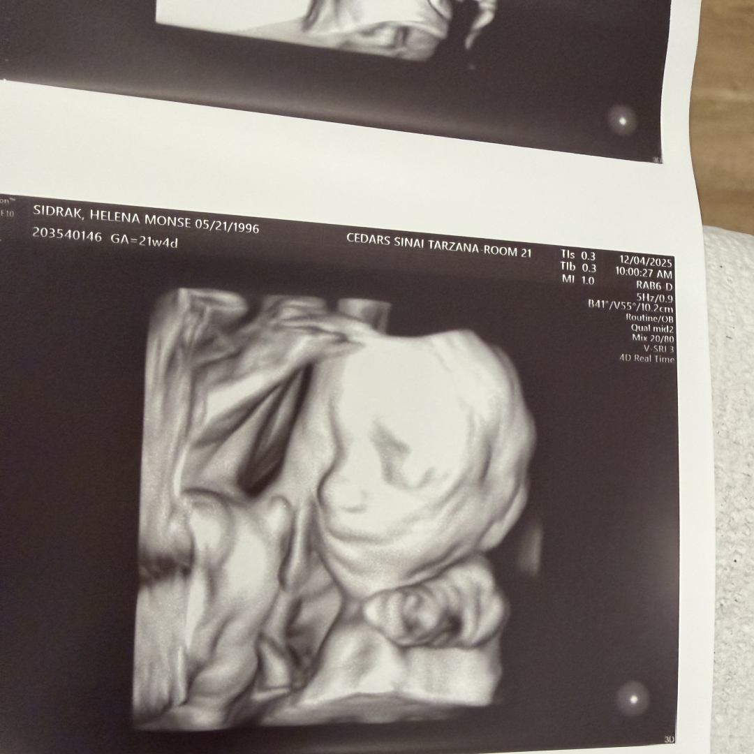 Photo shared by Bassem for their Babylist baby registry.