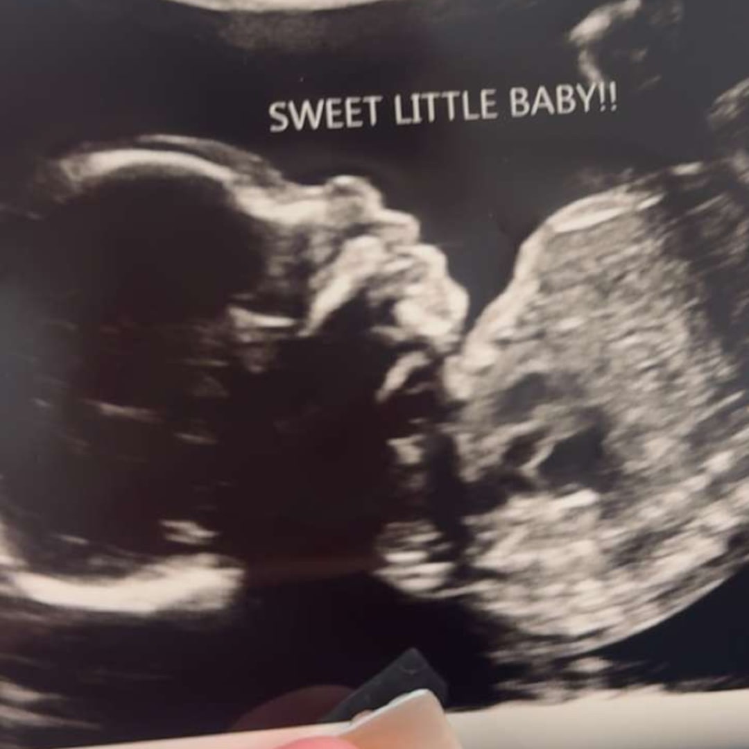 Photo shared by Erica for their Babylist baby registry.