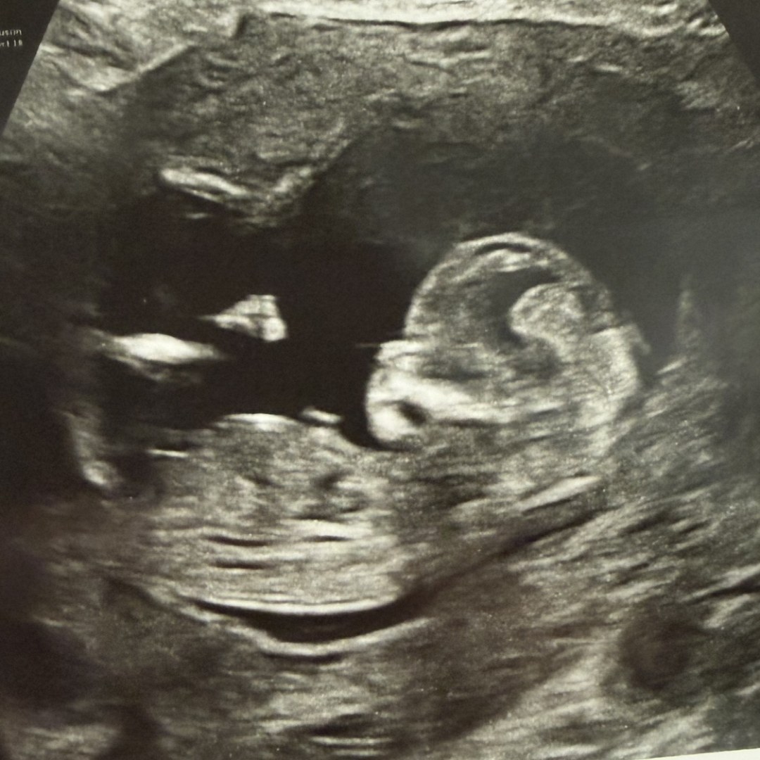 Photo shared by Kristen for their Babylist baby registry.