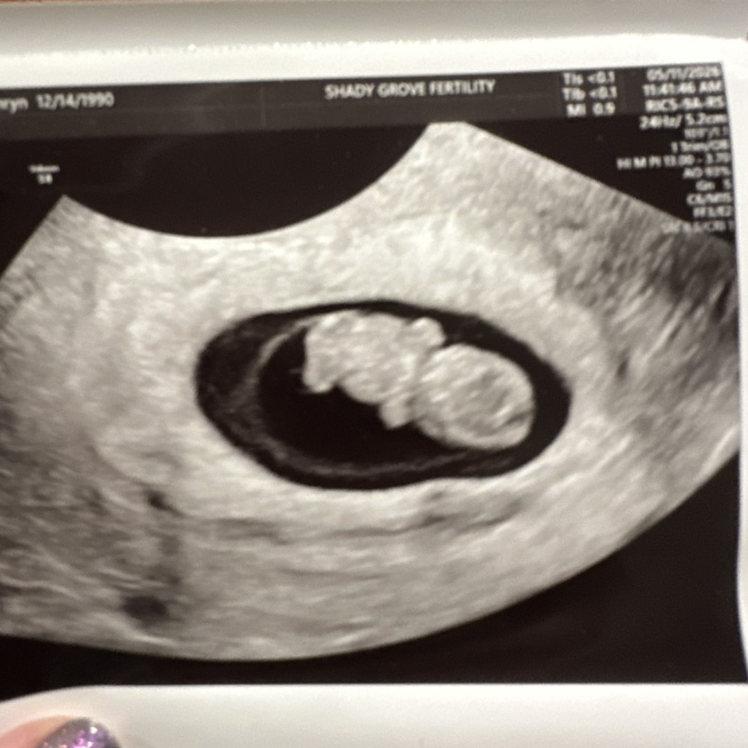 Photo shared by Kathryn for their Babylist baby registry.