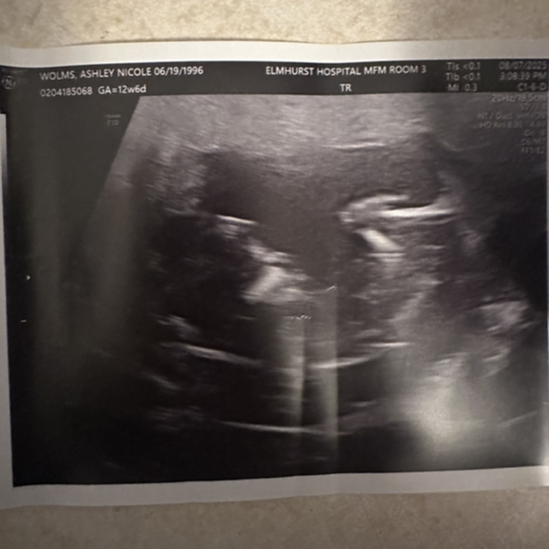 Photo shared by Ashley for their Babylist baby registry.