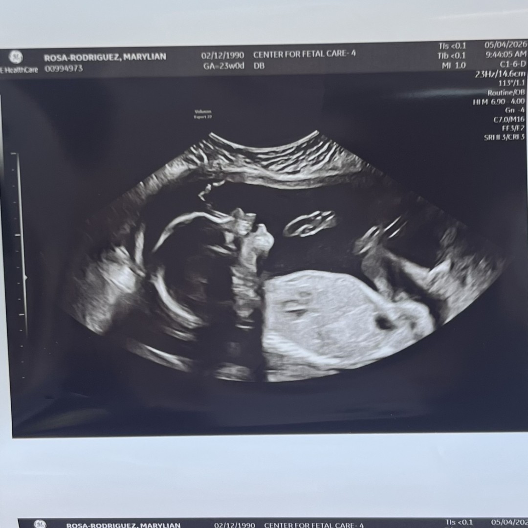 Photo shared by Marylian for their Babylist baby registry.