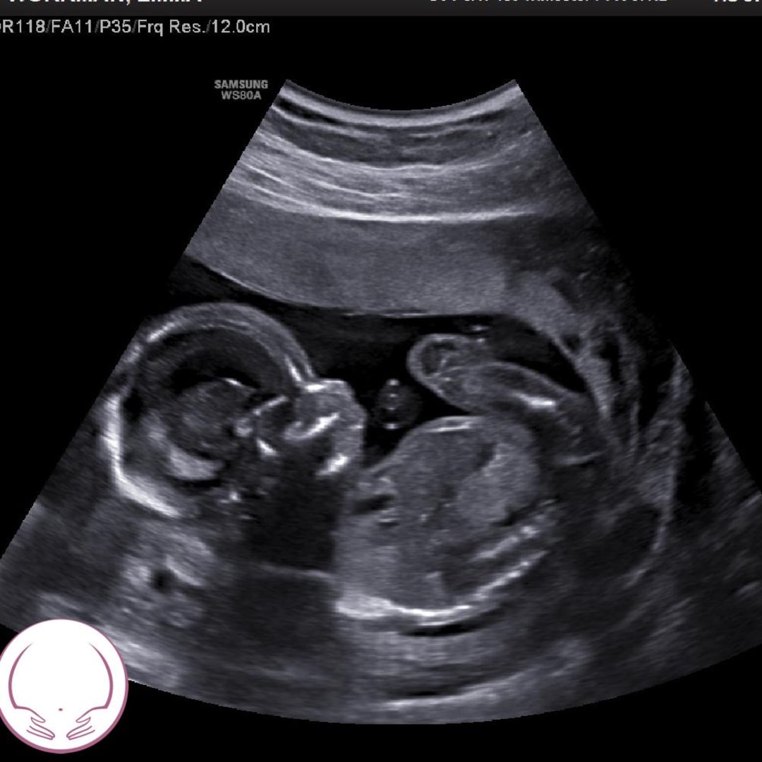 Photo shared by Em for their Babylist baby registry.