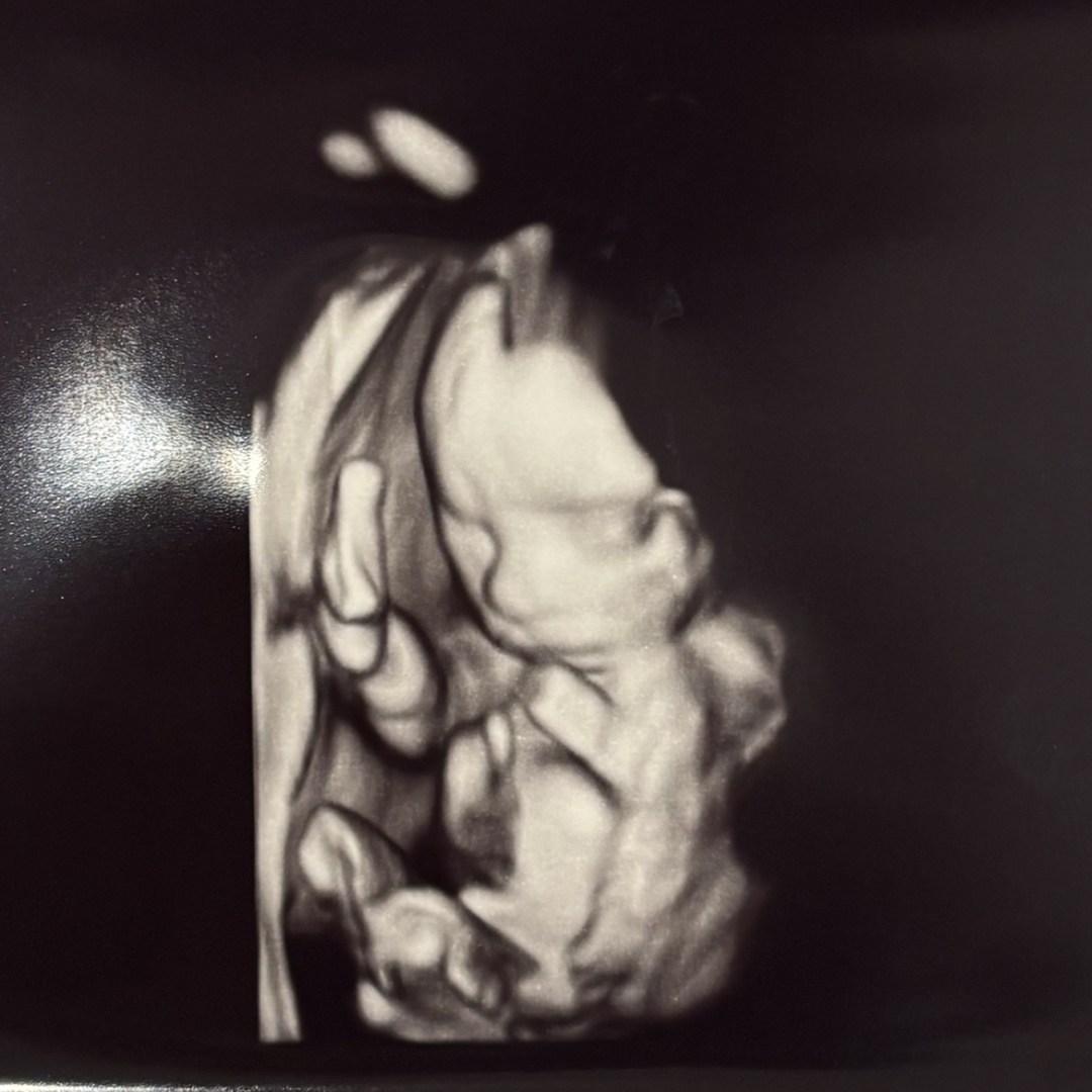 Photo shared by Leticia for their Babylist baby registry.
