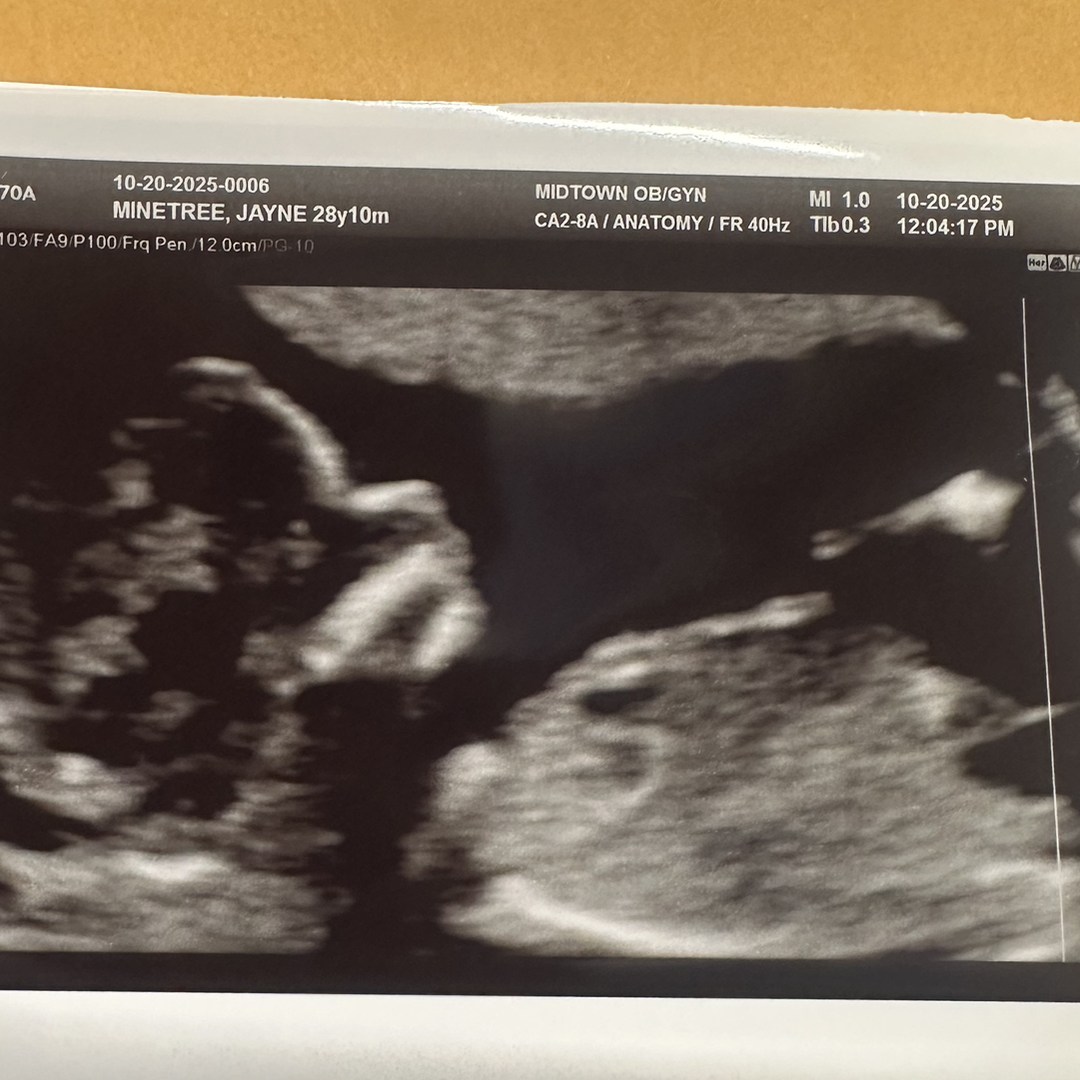 Photo shared by Jayne for their Babylist baby registry.