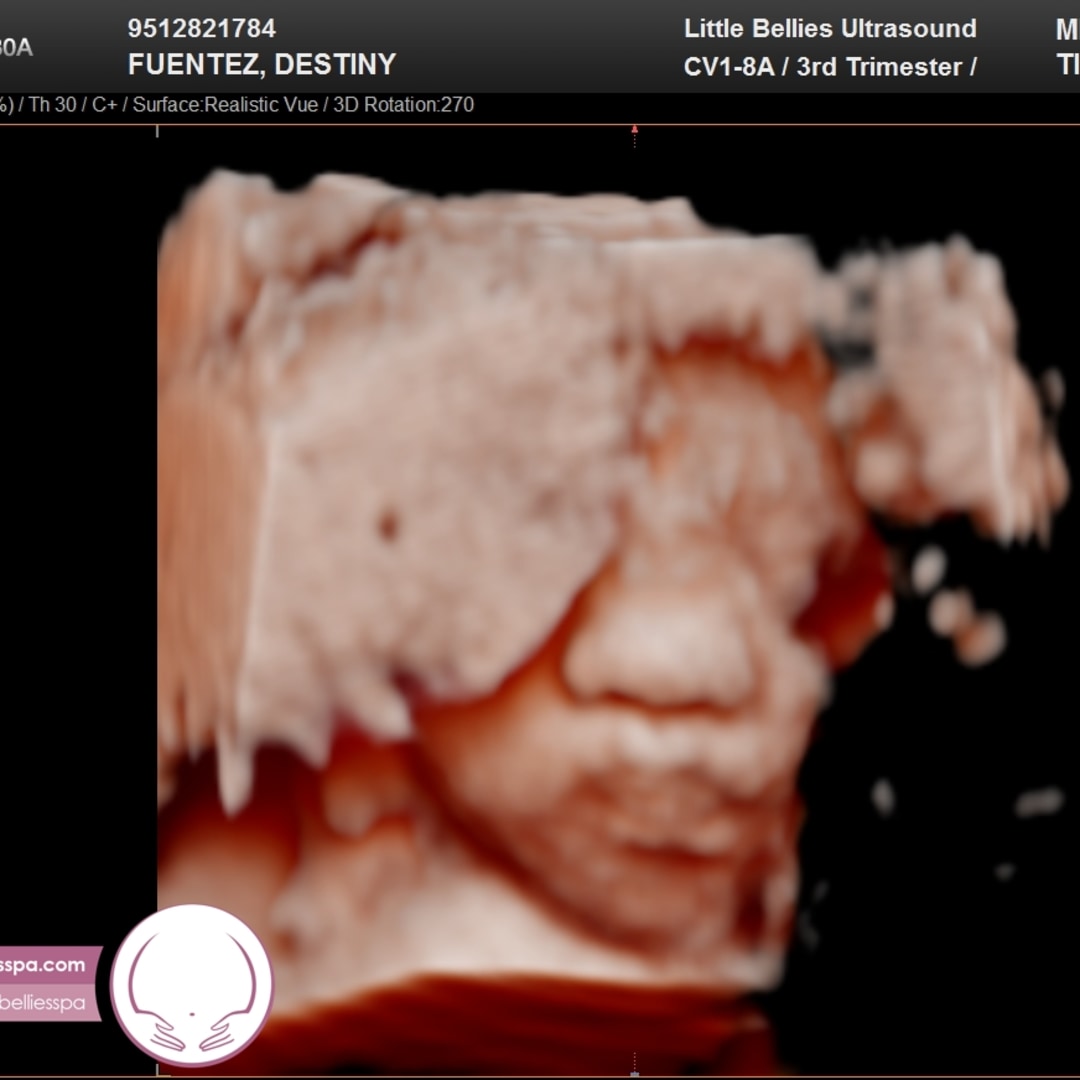 Photo shared by Destiny for their Babylist baby registry.