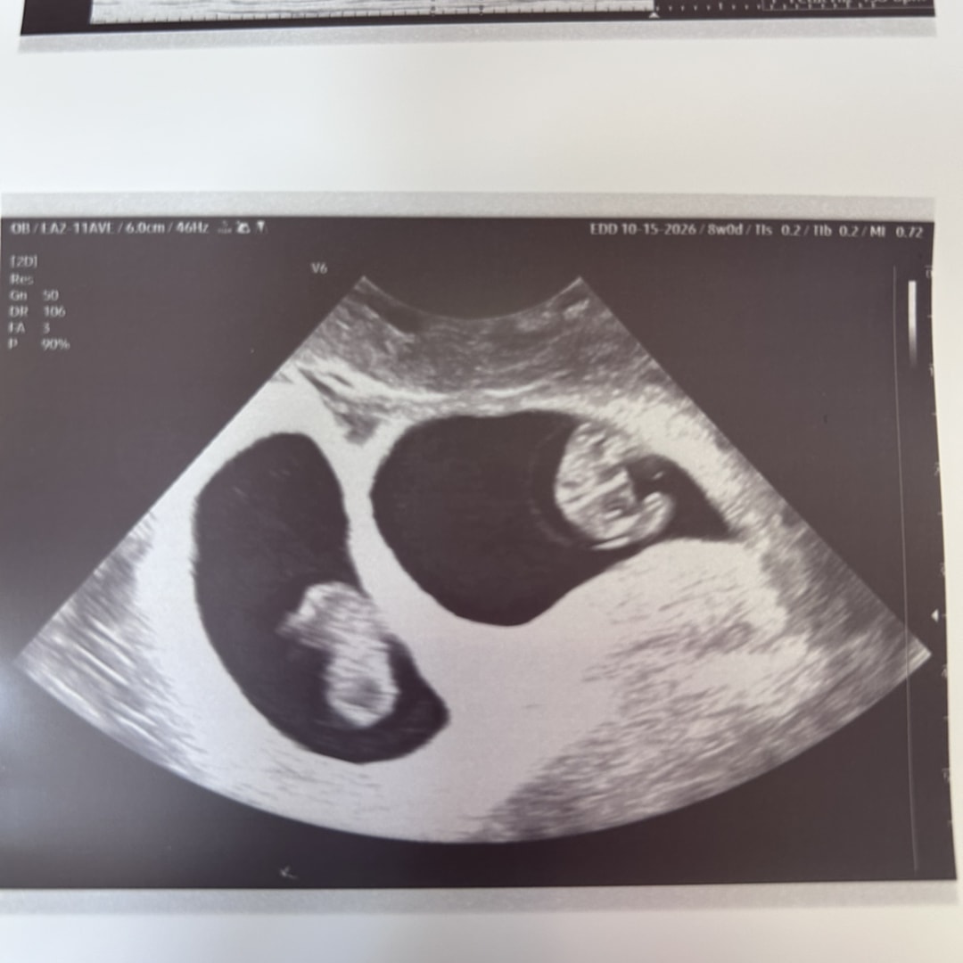 Photo shared by Emily for their Babylist baby registry.