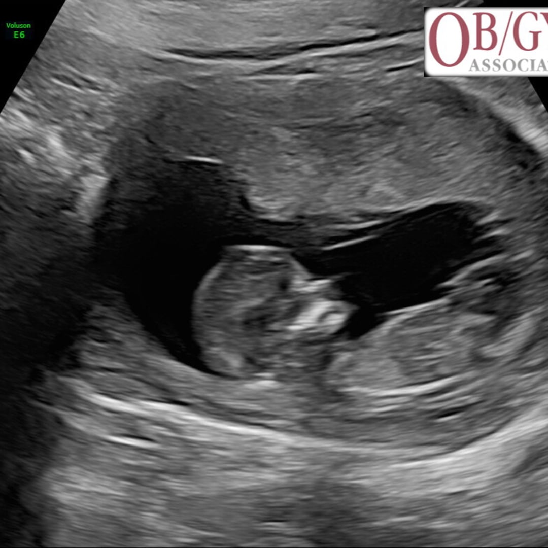 Photo shared by Rachel for their Babylist baby registry.