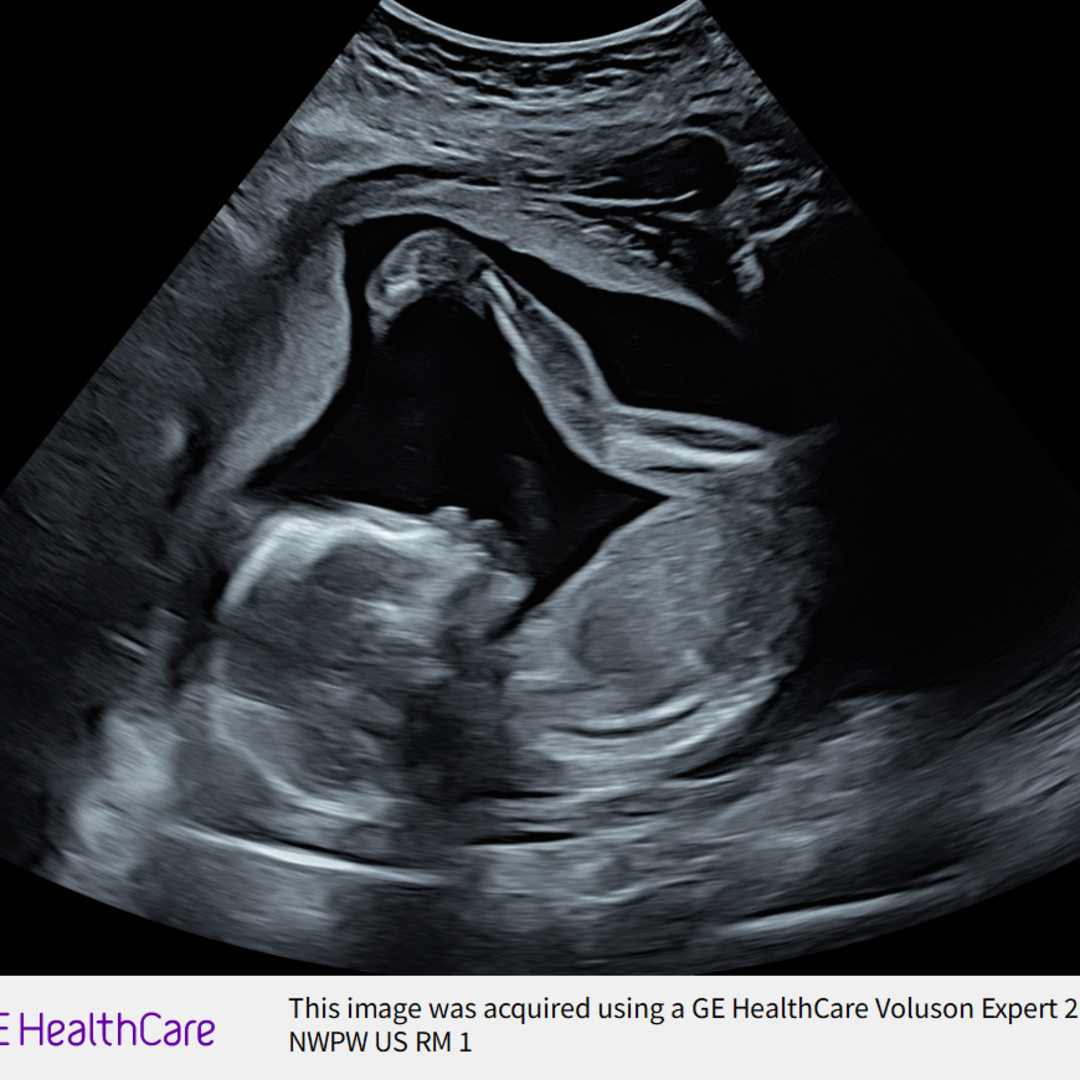 Photo shared by Alizabeth for their Babylist baby registry.