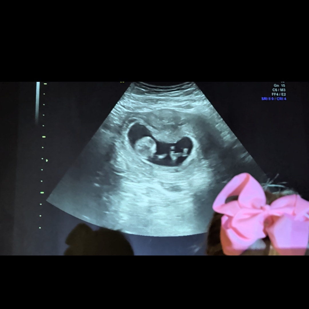 Photo shared by Megan for their Babylist baby registry.