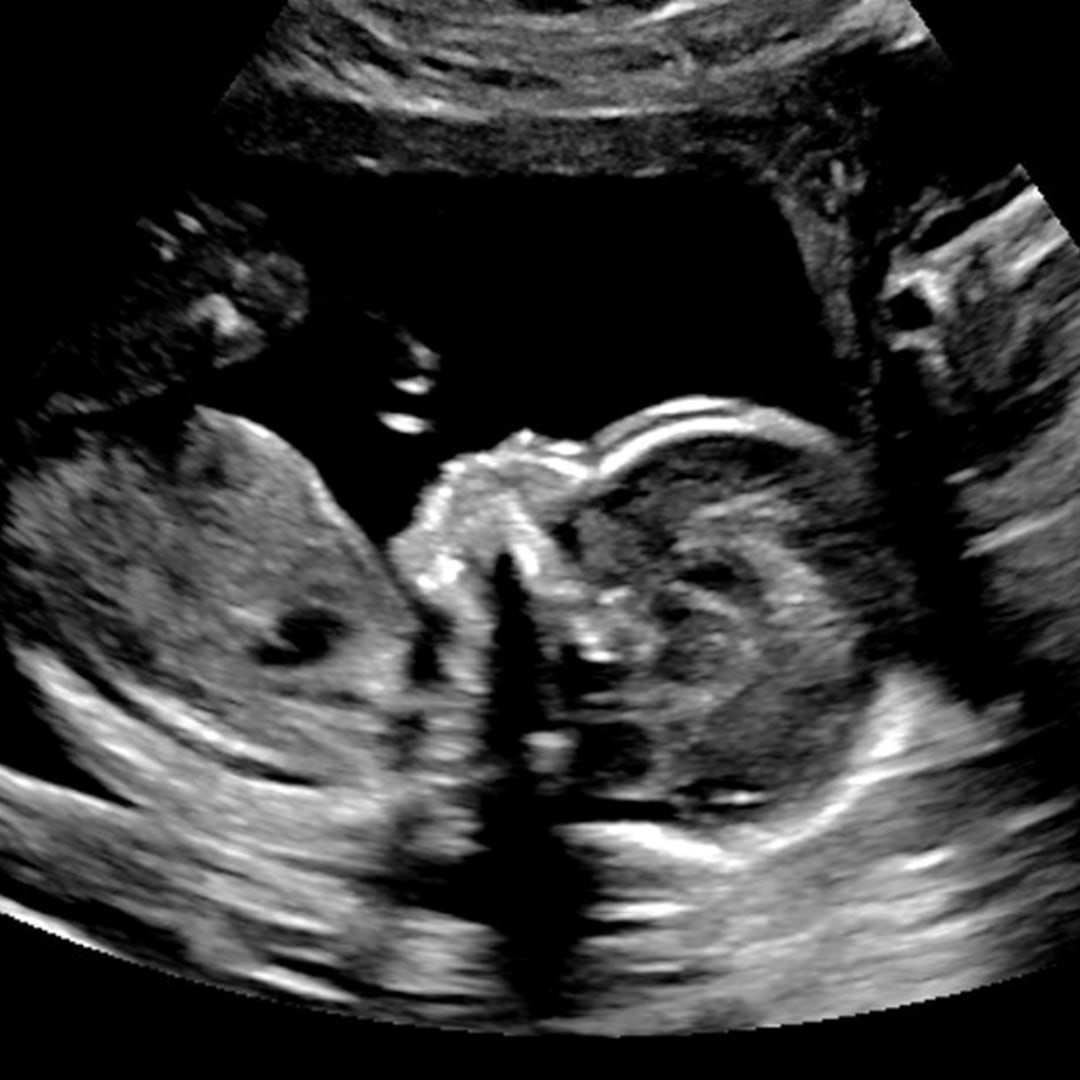 Photo shared by Jazalyn for their Babylist baby registry.